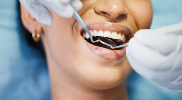 Best Urgent Tooth Repair  in White Oak, MS